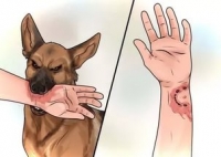Что делать, если укусила собака?