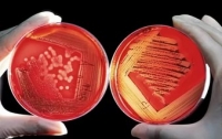 Новый тест на выявления инфекций, вызваных супербактериями