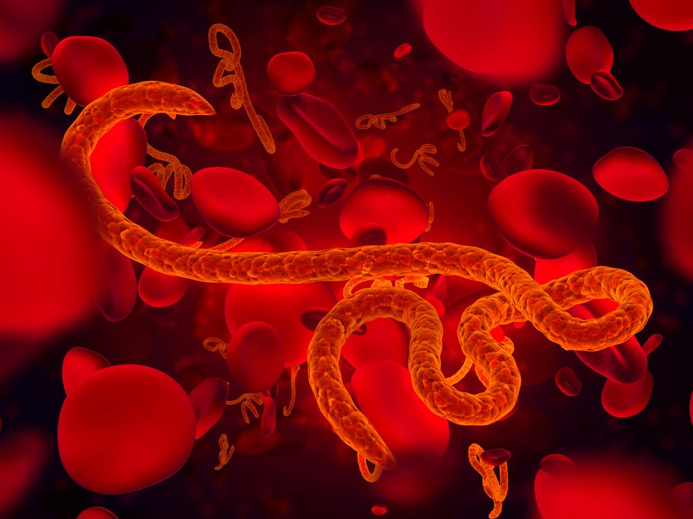 Лихорадка Эбола : симптомы, профилактика, диагностика и лечение