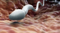 Лечение рака матки спермой