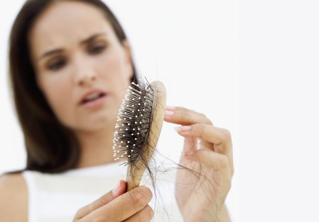 Выпадение волос: симптомы и лечение