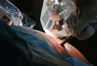 Российский робот-хирург провел первую операцию