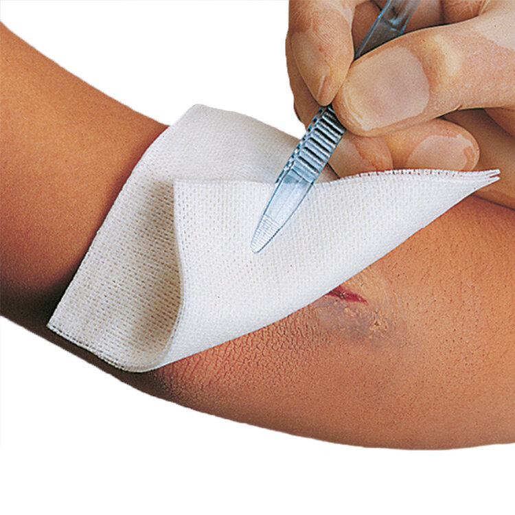 Ответы к тестам НМО: «Современные методы ухода за ранами в практике медицинской сестры хирургического кабинета»
