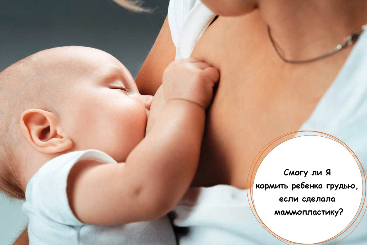 Маммопластика и кормление ребенка