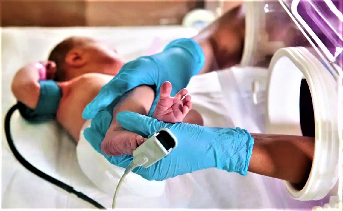 Ответы к тесту НМО: "Вспомогательный мониторинг в ОРИТ у новорожденных детей и детей раннего возраста после кардиохирургических операций. Роль медицинской сестры"