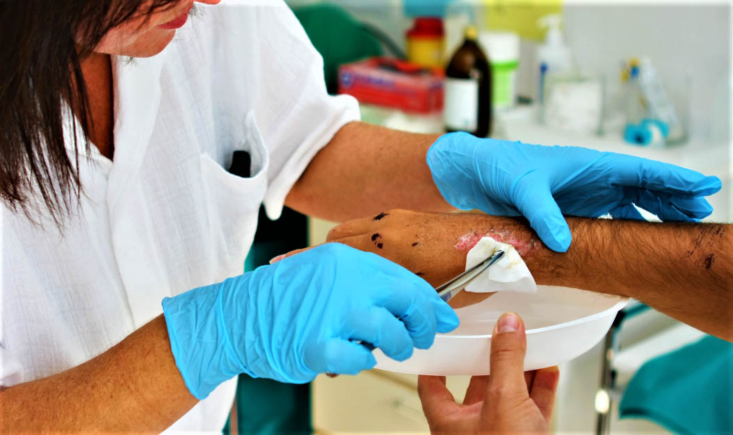 Ответы к тестам НМО: "Первичная хирургическая обработка раны"
