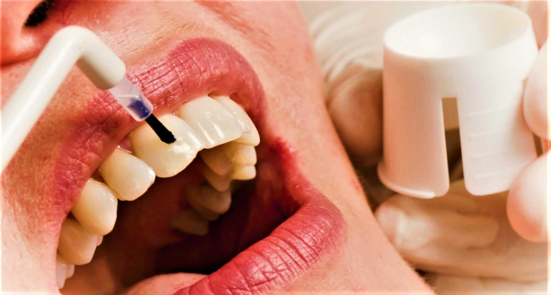 Ответы к тестам НМО: "Реминерализация зубной эмали"