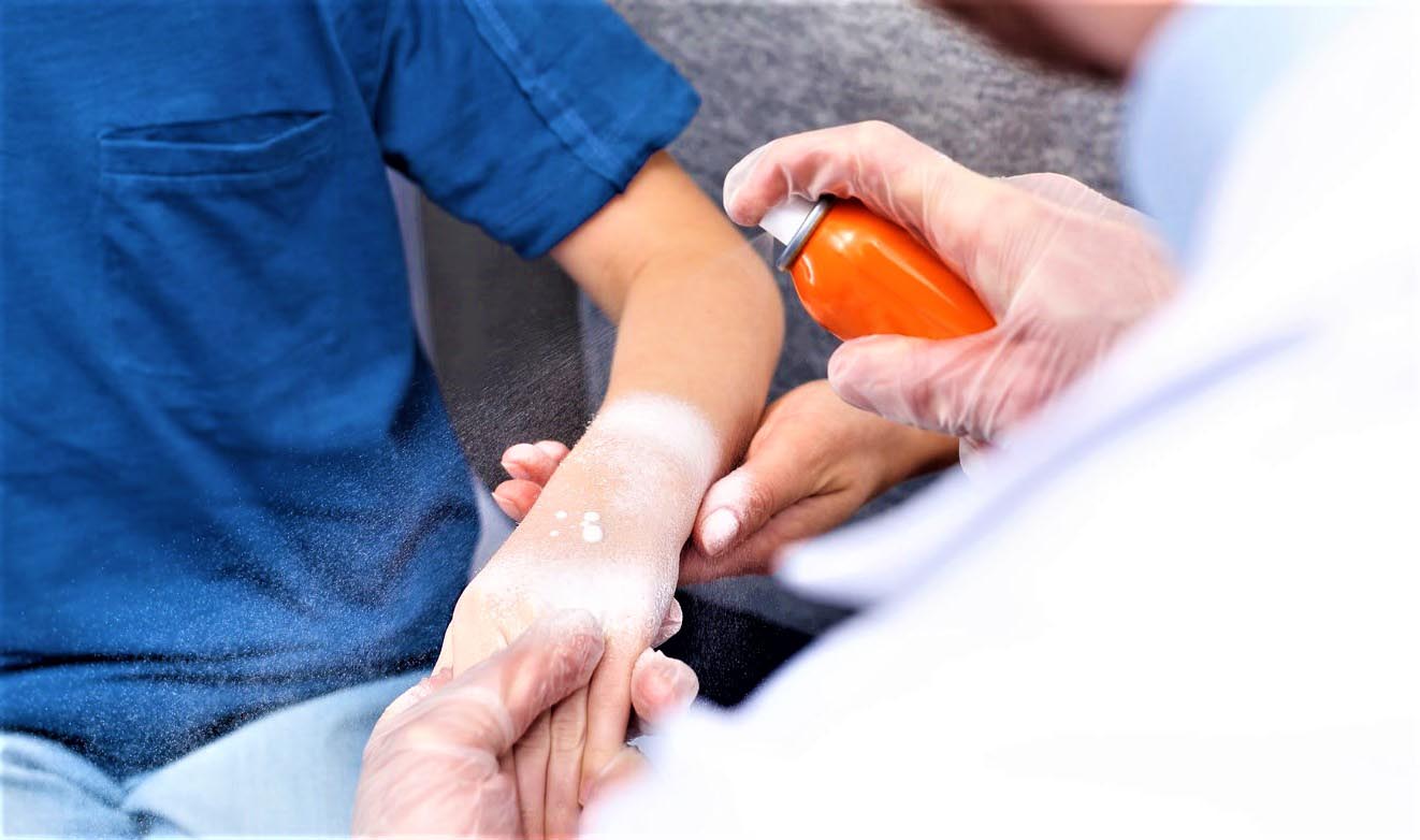 Ответы к тестам НМО: "Организация оказания медицинской помощи в чрезвычайных ситуациях пострадавшим с термической травмой"