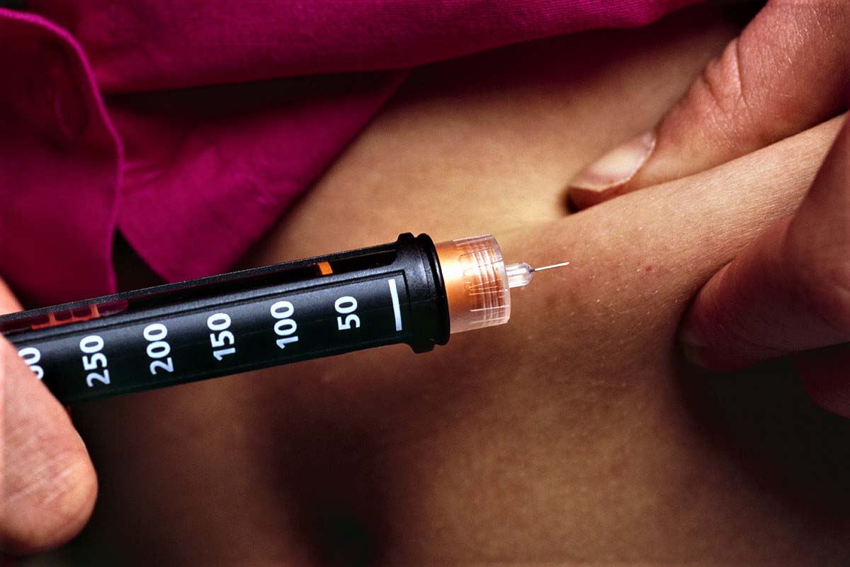 Ответы к тестам НМО: "Сестринский уход за больным сахарным диабетом: инсулинотерапия"