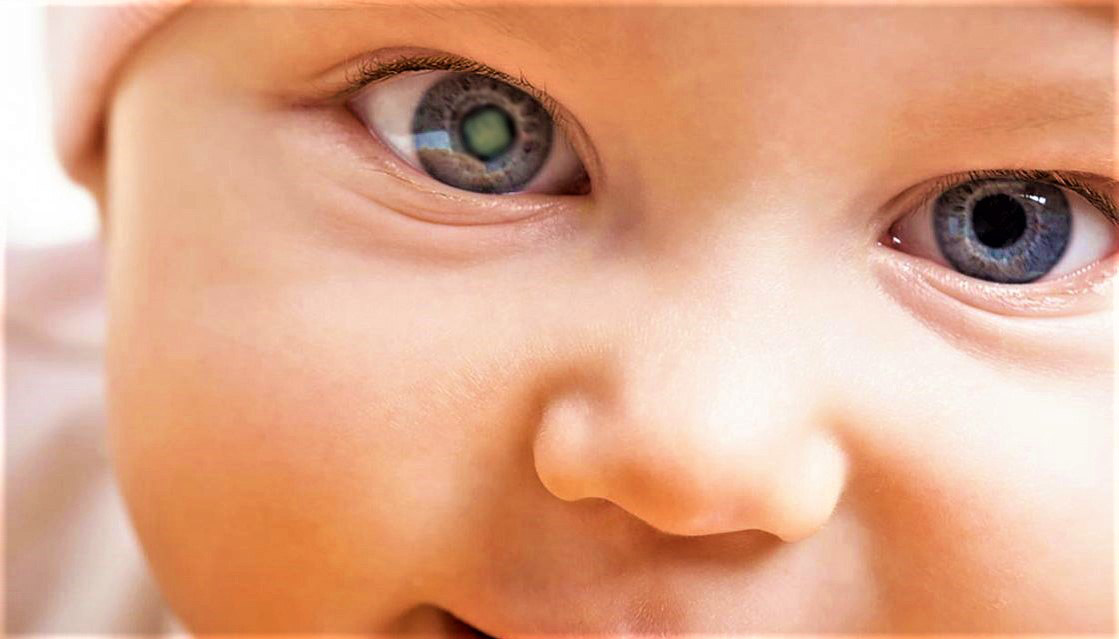 Ответы к тестам НМО: "Современные подходы к хирургическому лечению врожденных катаракт"