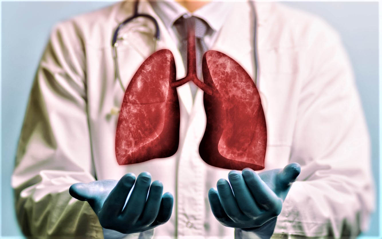 Ответы к тестам НМО: "Клиническая трансплантация лёгких"