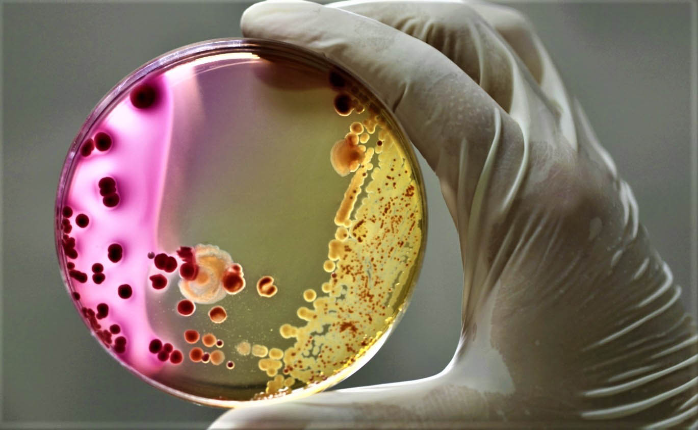 Роль микроорганизмов в инфекционных процессах