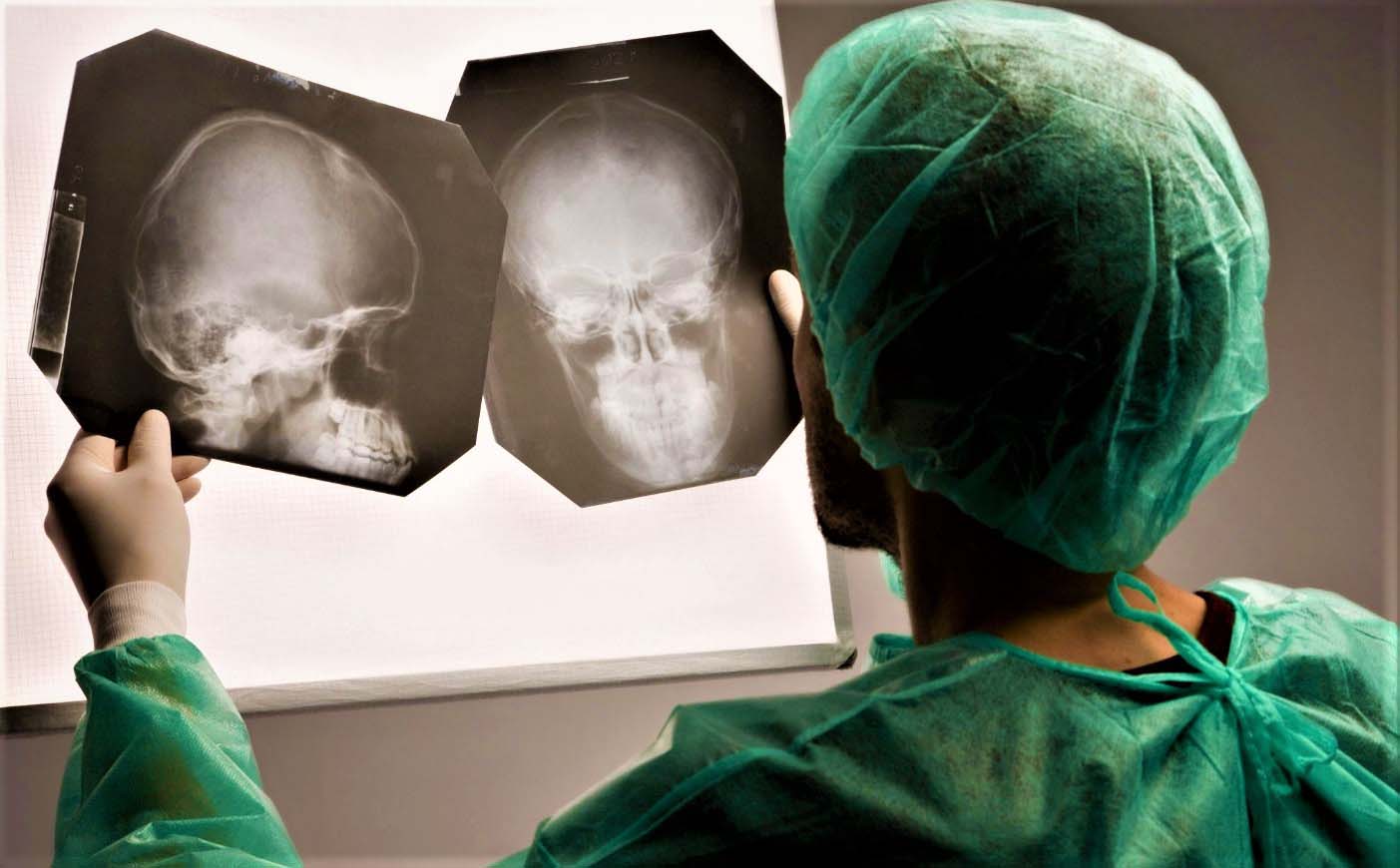 Ответы к тестам НМО: "Тяжелая черепно-мозговая травма. Диагностика (по утвержденным клиническим рекомендациям)"