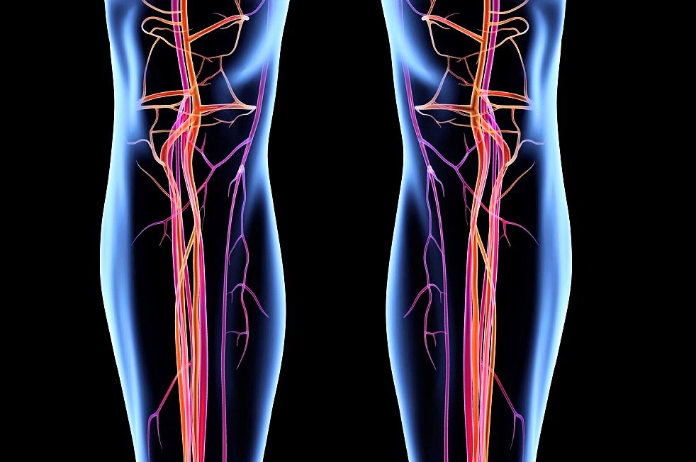 Ответы к тестам НМО: "Заболевания артерий нижних конечностей. Диагностика (по утвержденным клиническим рекомендациям)"