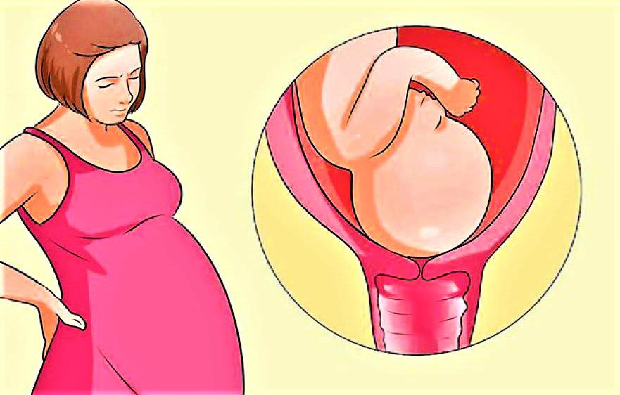 Ответы к тестам НМО: "Изменения матки и шейки матки во время беременности и накануне родов"