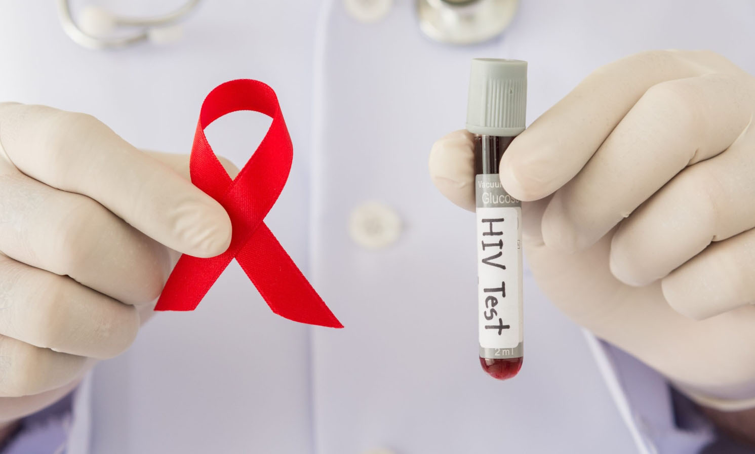 Ответы к тестам НМО: "ВИЧ-инфекция у взрослых: лечение (по утвержденным клиническим рекомендациям)"
