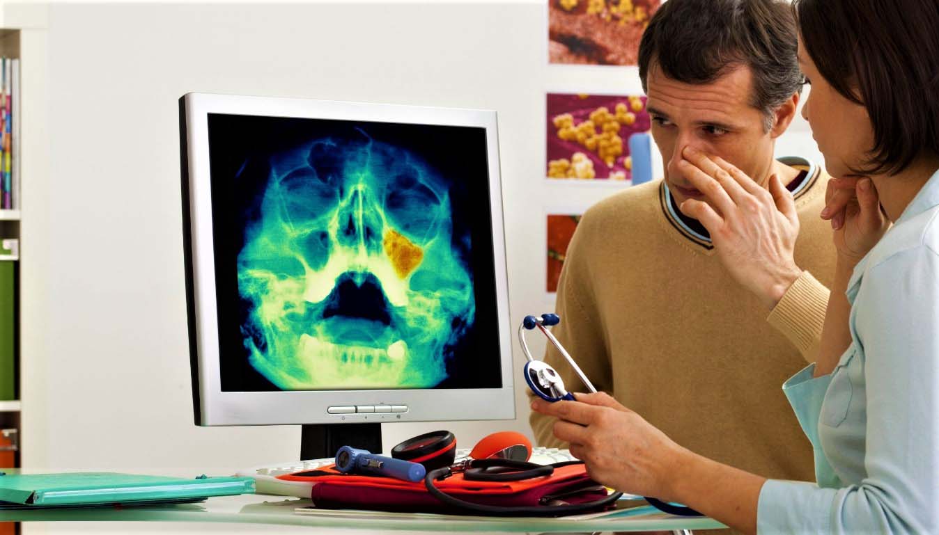 Ответы к тестам НМО: "Диагностика и лечение травм носа и околоносовых пазух"