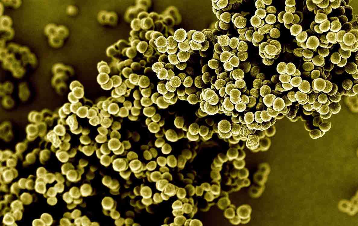 Ответы к тестам НМО: "Антибактериальные препараты для лечения стафилококковых инфекций"