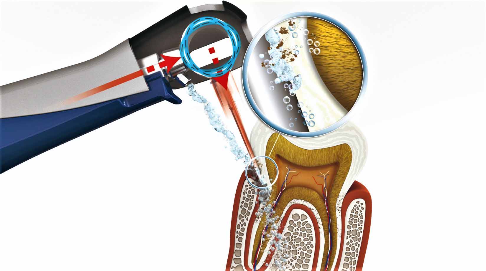 Ответы к тестам НМО: "Вектор-терапия в стоматологии"