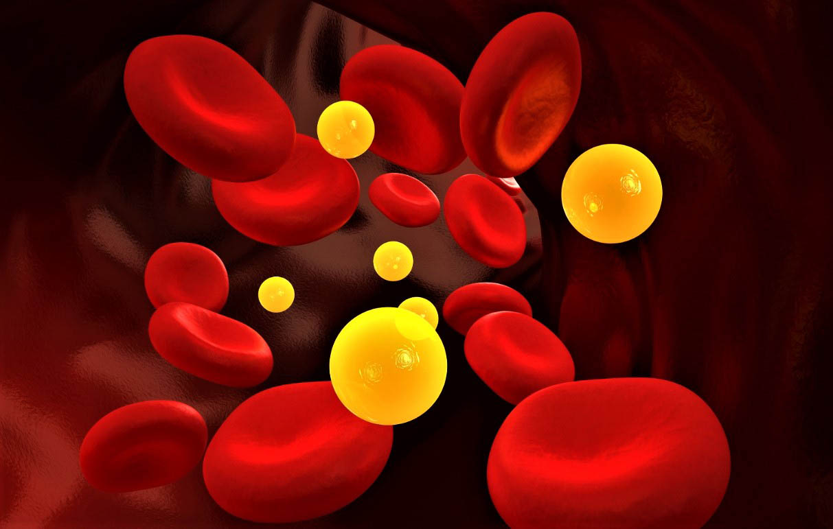 Ответы к тестам НМО: "Как достичь оптимального контроля уровня липидов крови"