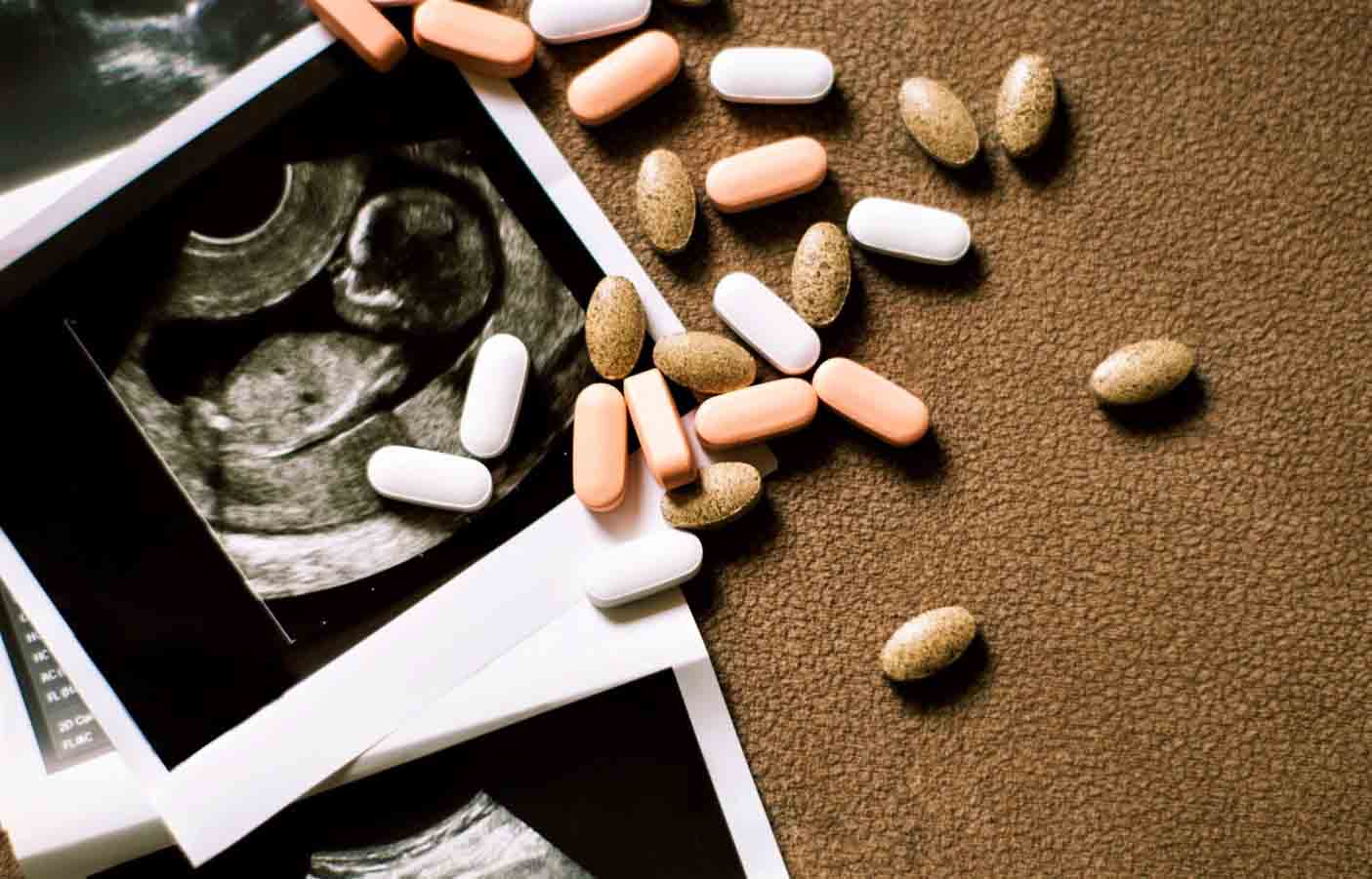 Медикаментозное прерывание беременности (аборт)