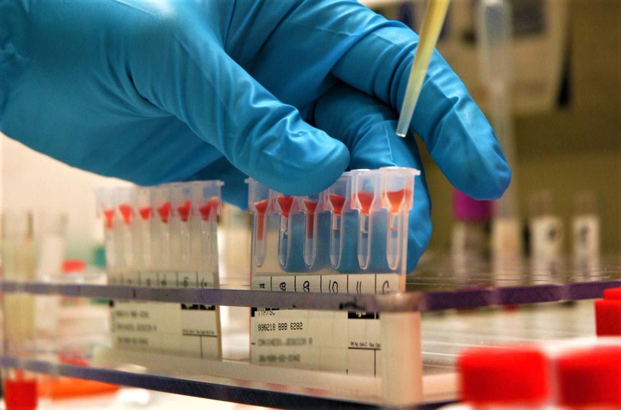 Ответы к тестам НМО: "Методы проведения иммуногематологических исследований"