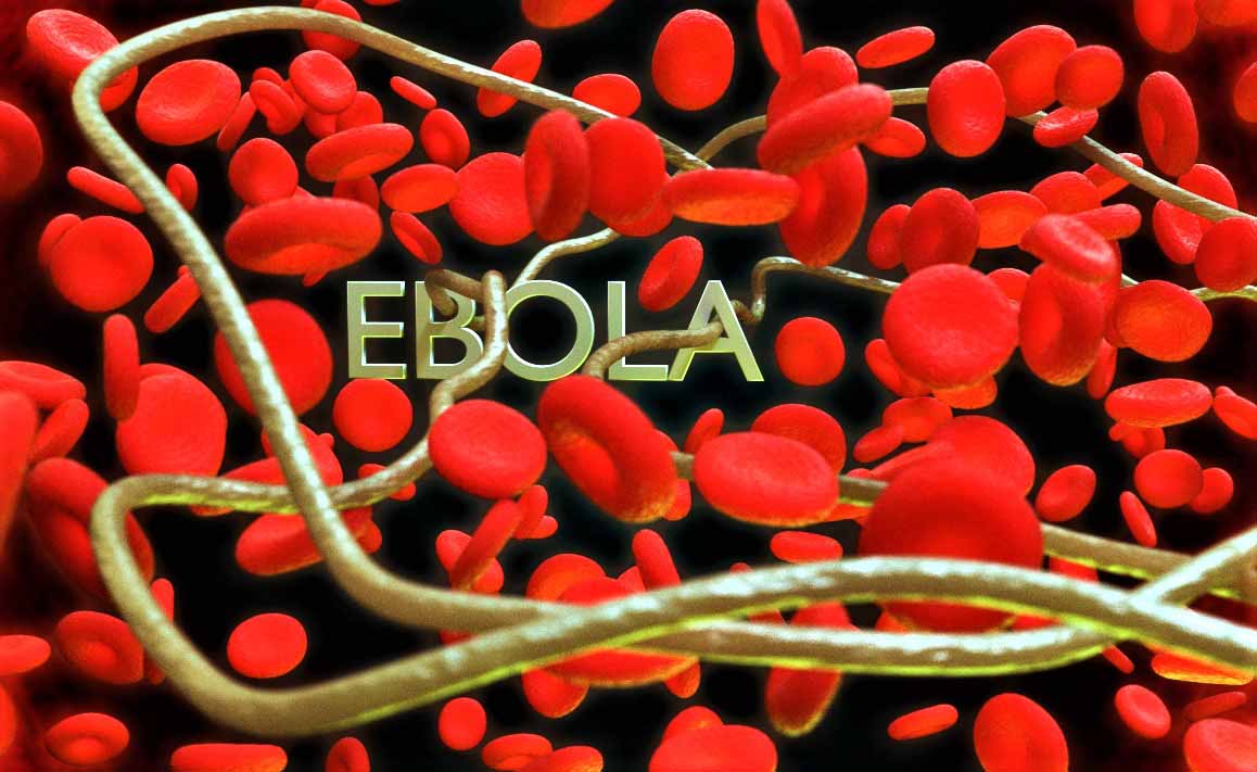 Ответы к тестам НМО: "Болезнь, вызванная вирусом Эбола: этиология, клинико-лабораторная диагностика, лечение."