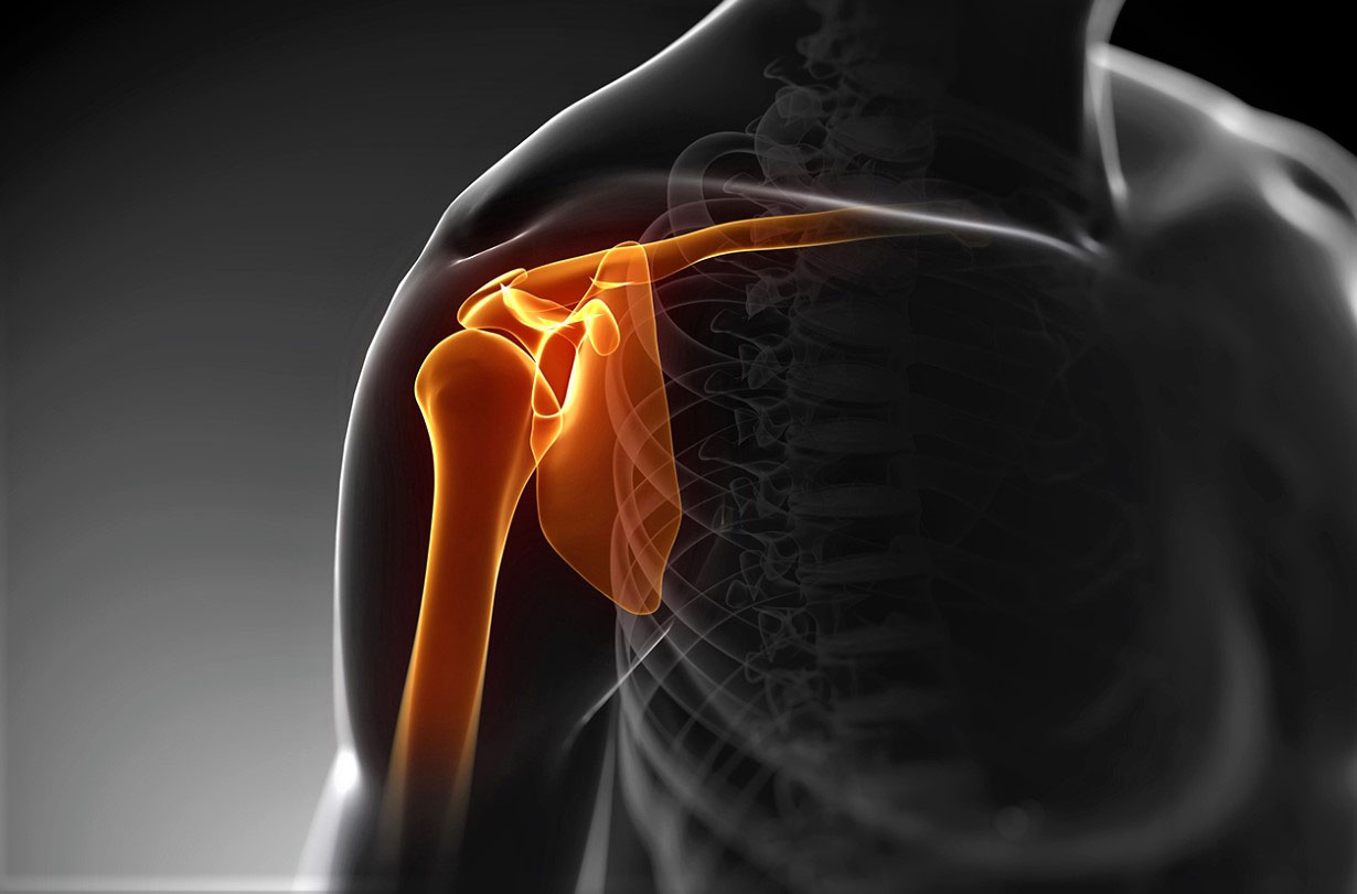 Ответы к тестам НМО: "Артроскопические методы лечения посттравматической патологии плечевого сустава (нестабильность плечевого сустава)"