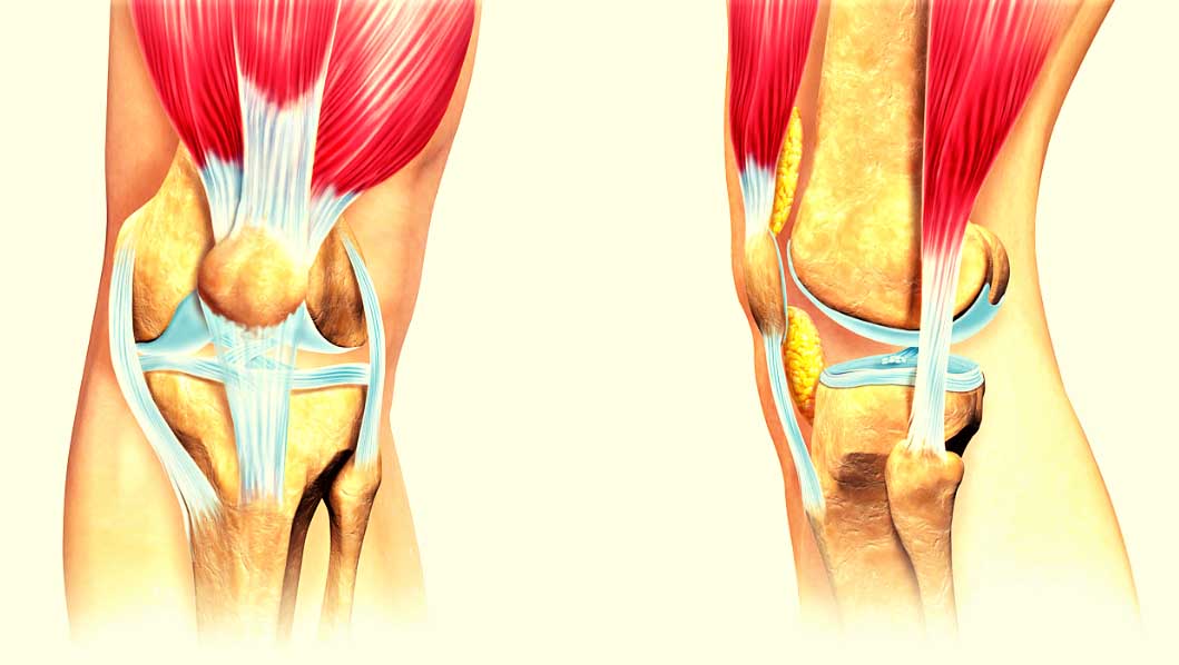 Ответы к тестам НМО: "Повреждения разгибательного аппарата коленного сустава"