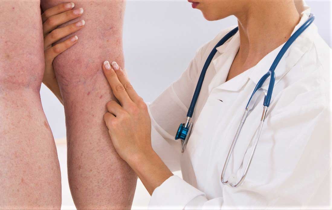 Ответы к тестам НМО: "Васкулиты, ограниченные кожей (по утвержденным клиническим рекомендациям)"