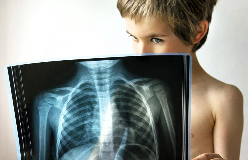 Ответы к тестам НМО: "Туберкулёз у детей и подростков"