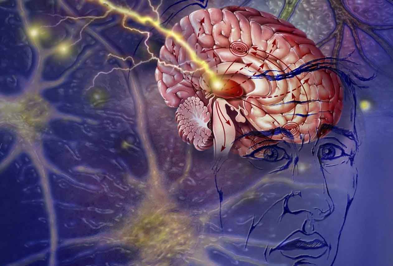 Ответы к тестам НМО: "Психические расстройства при эпилепсии"