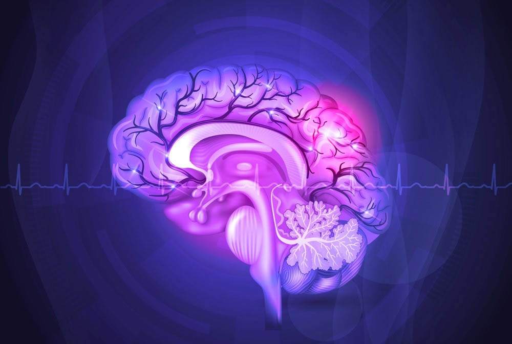 Ответы к тестам НМО: "Нейровизуализация эпилепсий"