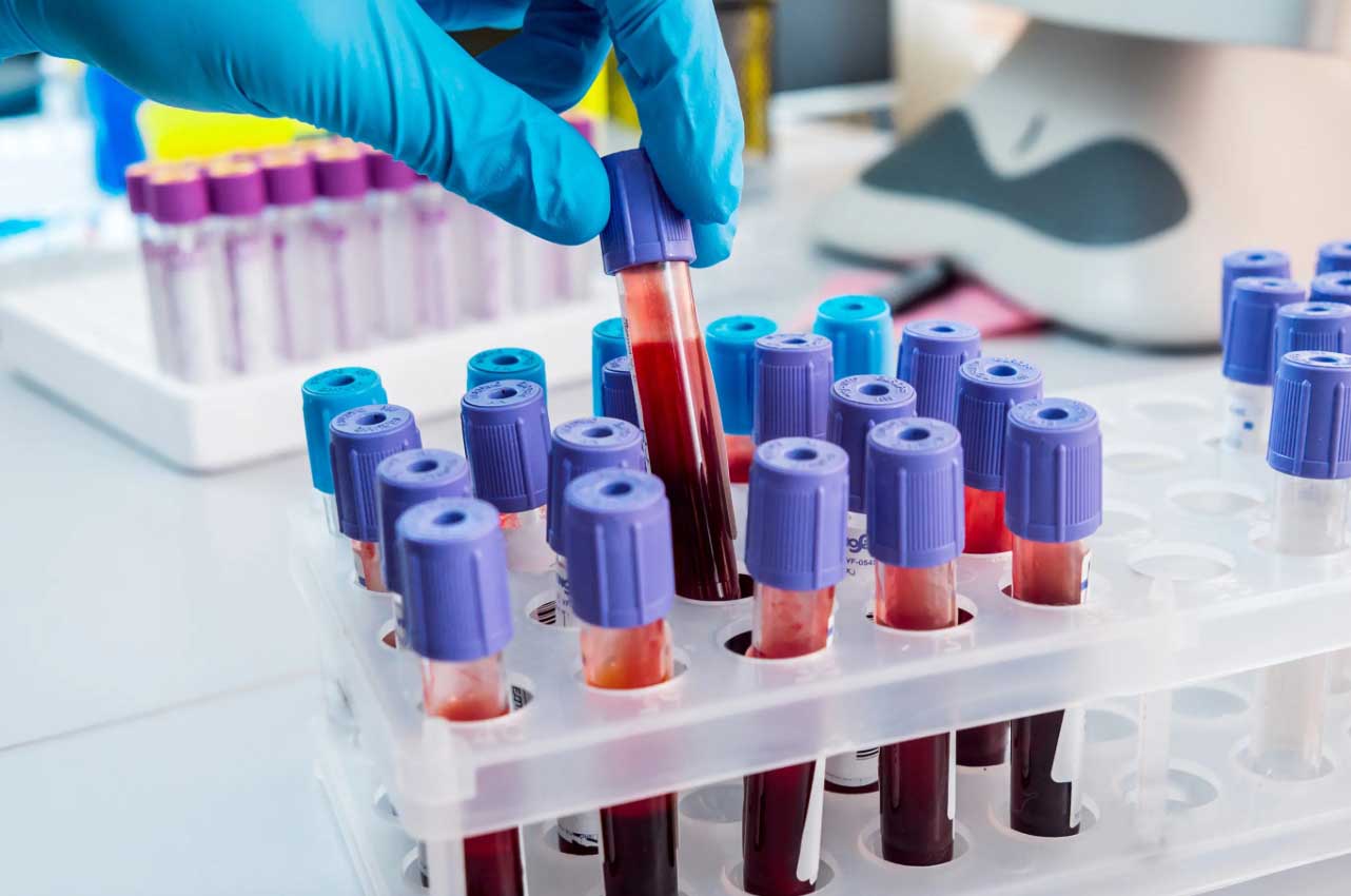 Ответы к тестам НМО: "Лабораторные показатели железодефицитной анемии"