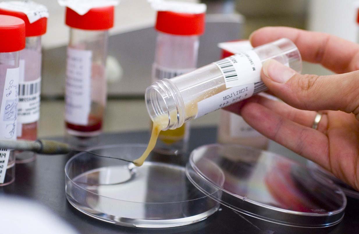 Ответы к тестам НМО: "Лабораторные методы в диагностике туберкулеза"