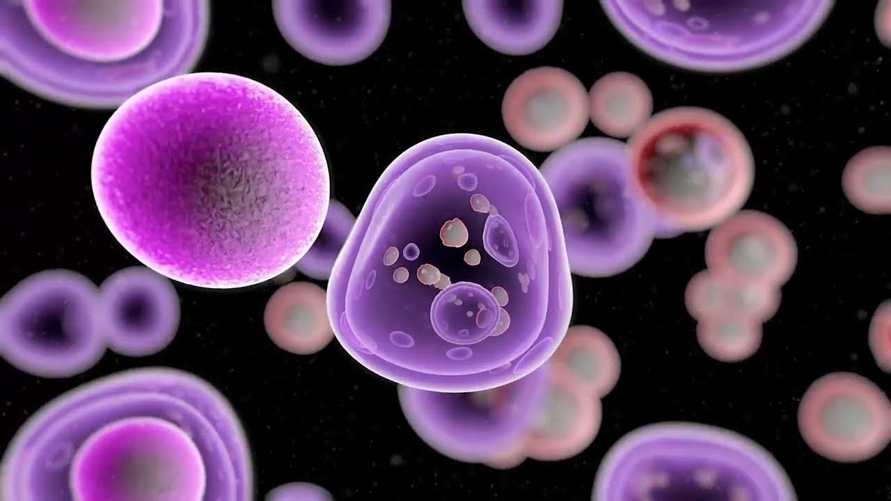 Ответы к тестам НМО: "Диагностика диффузной В-клеточной крупноклеточной лимфомы"