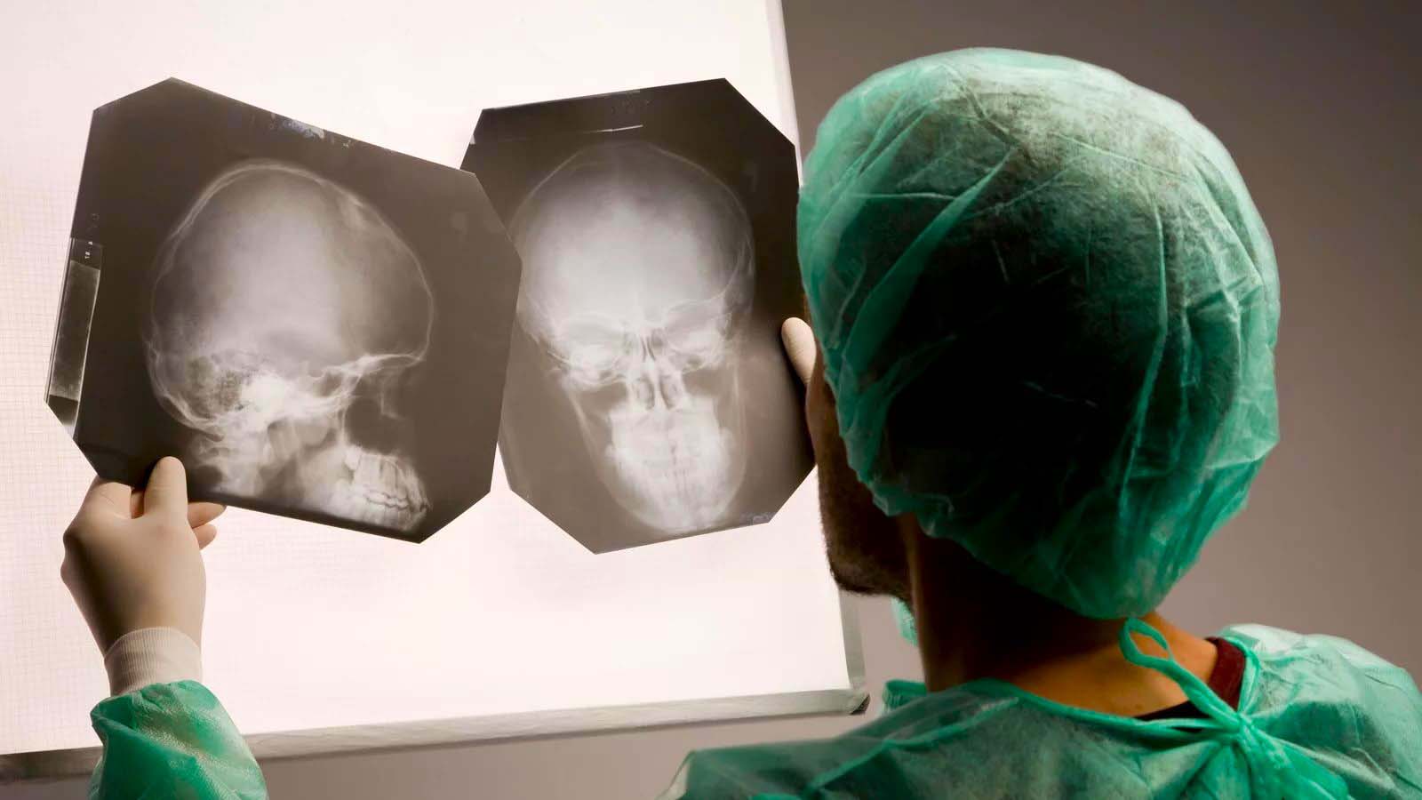 Ответы к тестам НМО: "Лечение травматических повреждений костей лицевого скелета"