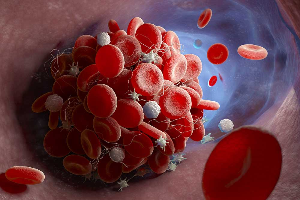 Ответы к тестам НМО: "Лекарственные средства, влияющие на агрегацию тромбоцитов, свертывание крови и фибринолиз"