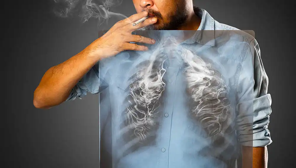 Кашель курильщика: причины, симптомы и методы лечения