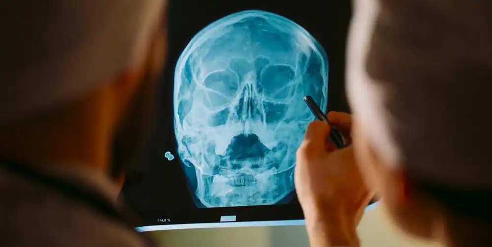 Аксиальная и полуаксиальная рентгенография: эффективные метод визуализации для специалистов